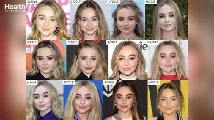 Sabrina Carpenter's Journey: Embracing Change With Botox?