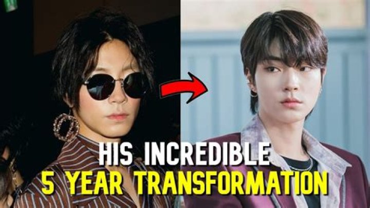 Unveiling The Transformation: Hwang In Yeop Before Surgery