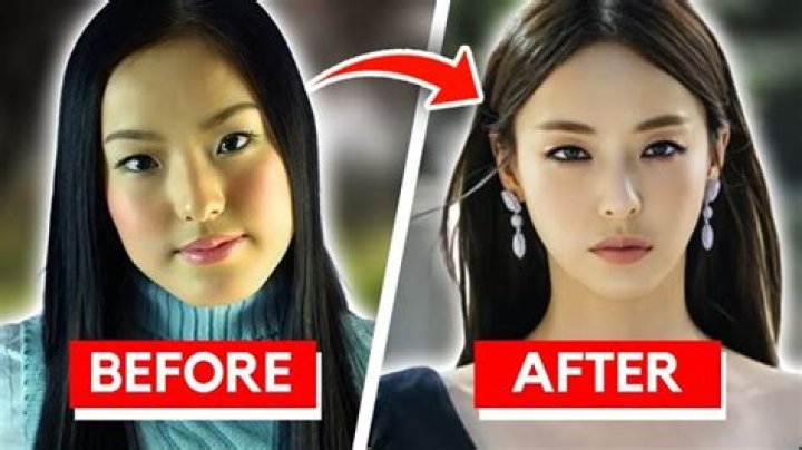 Unveiling The Truth: Do Korean Actors Get Plastic Surgery?